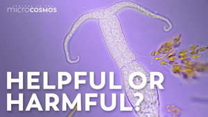 Are Microbes Good or Bad for Humans? still
