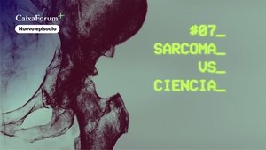 Sarcoma vs Ciencia