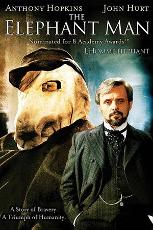 Постер фильма «Человек-слон (1980)» — (13 из 97)