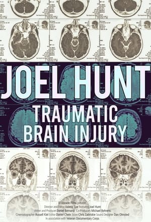 Image Joel Hunt: Traumatic Brain Injury (TBI)