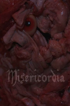 Misericordia