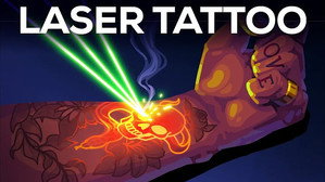 Kurzgesagt - In a Nutshell Tattoo Removal Is Insane