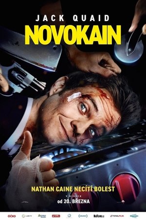 Image Novokain