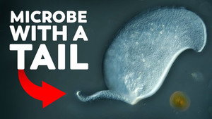 This Microbe Hasn't Been Seen Since The 1930s still