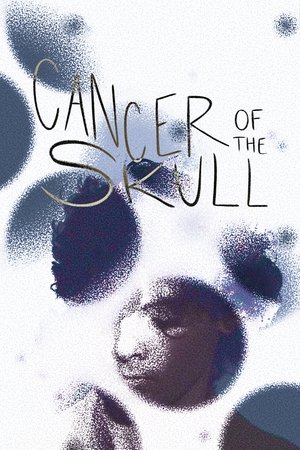 Cancer of the Skull