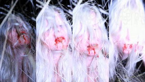 White Epilepsy 6