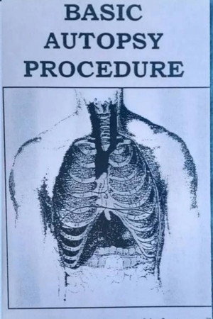 Basic Autopsy Procedure