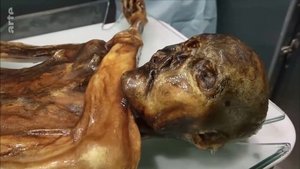 Ötzi, la renaissance de l'homme des glaces