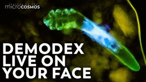 These Mites Are Probably On Your Face Right Now still