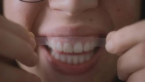 Des dents blanches… au rire jaune !