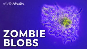 Amoebas: Occasional Brain-Eaters still