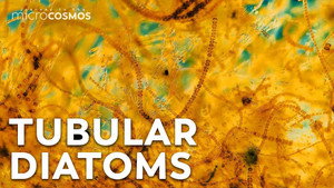 The Tube-dwelling Architects Of The Microcosmos still