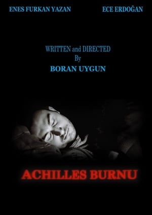 Image Achilles Burnu