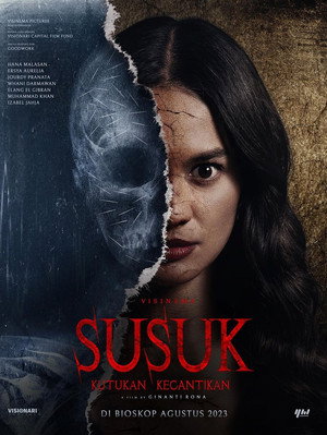 Susuk 3