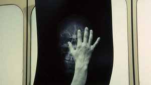 Sur la table d'opération