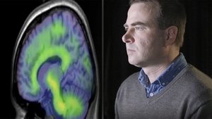 Alzheimer's - Can We Prevent It?