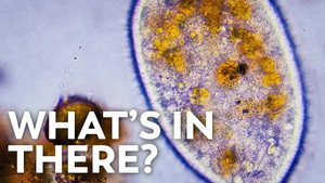 Mysterious Jiggly Crystals and Other Intracellular Structures still
