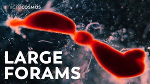 Why Are These Single-Celled Organisms So Large? still