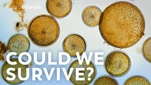 What If All the Microbes Disappeared? still