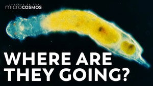 The Indecisive Evolution of Gastrotrichs still