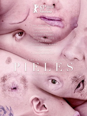 Skins 17