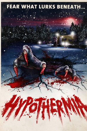 Hypothermia