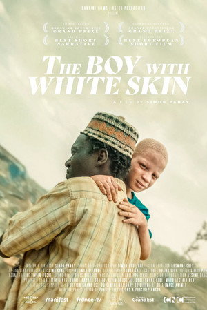 The Boy with White Skin