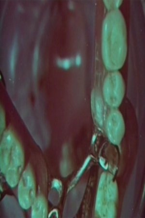 Macrozoom