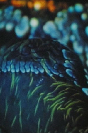 Arytmia