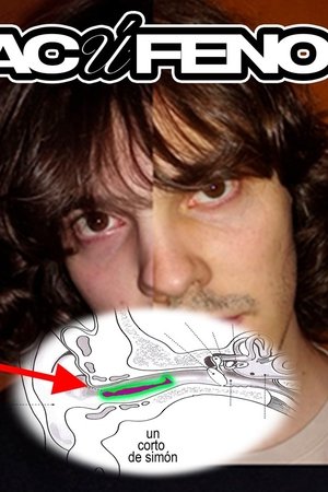 Acúfeno