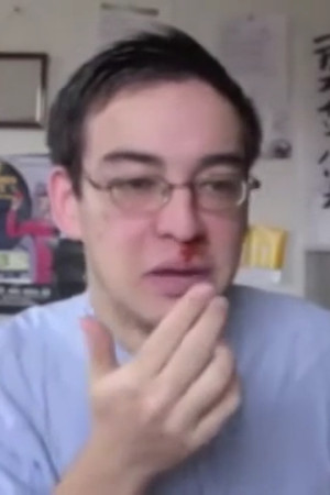 Epic Nosebleed