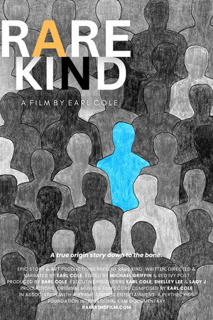 Rare Kind