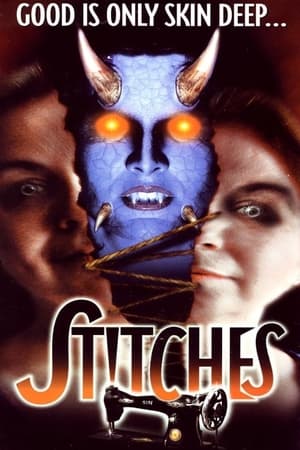 Stitches
