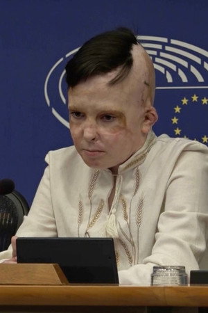 Ukraine: The Face of War