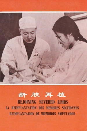 Rejoining Severed Limbs