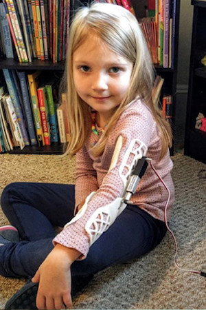 Father Builds Daughter's Robotic Arm with No Experience
