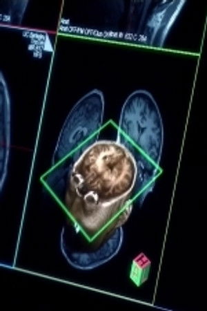 Lze ovládnout naši mysl?