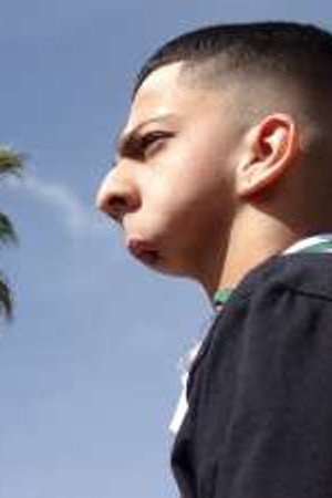 Boy with no Jaw