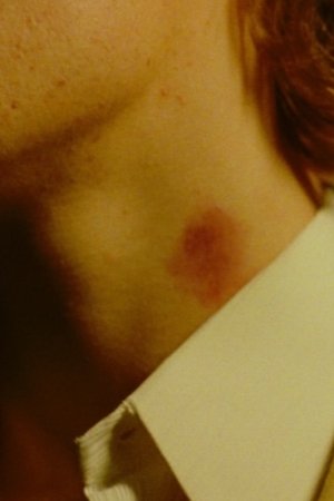 The Hickey