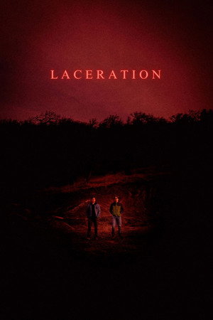 Laceration