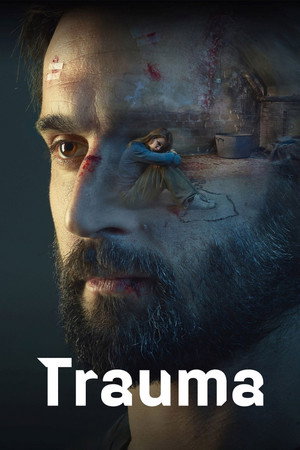 Trauma