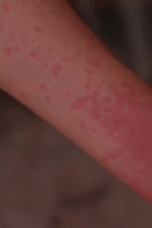 13. epizoda