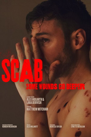 Scab
