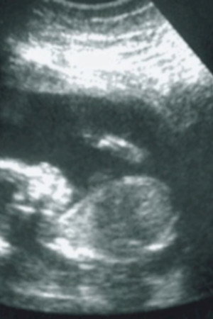 50 Fetus - In Da Whomb