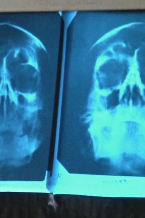 The Two Deaths of Adolf Hitler