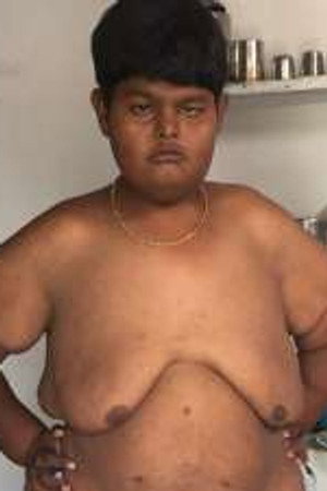 Boy with no eyes