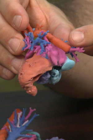 3D Printed Hearts