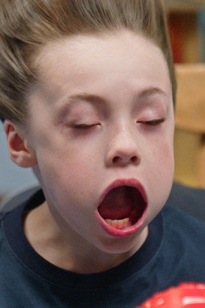 Cookie Sickness
