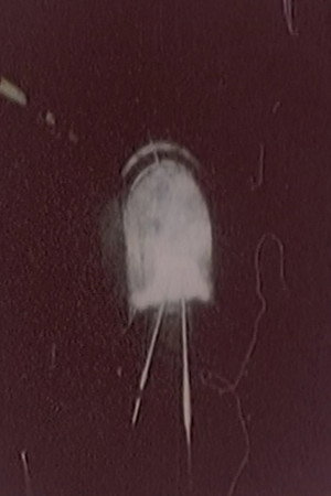 Hibaku Ningen X