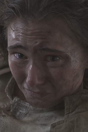 Trauma